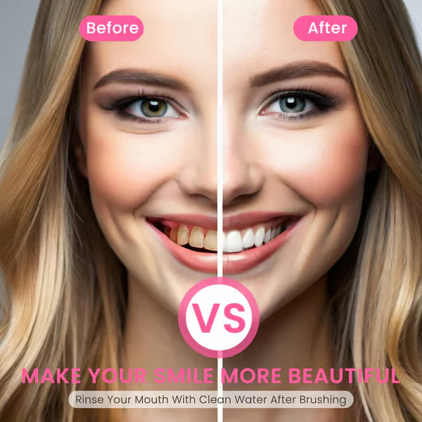 š„Nicotinamide Probiotic Whitening Toothpaste - Free of Fluoride, Nicotinamide, Anti plaque