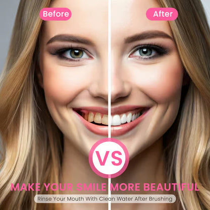 🔥Nicotinamide Probiotic Whitening Toothpaste - Free of Fluoride, Nicotinamide, Anti plaque
